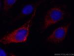 SNX5 Antibody in Immunocytochemistry (ICC/IF)