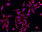 RPS12 Antibody in Immunocytochemistry (ICC/IF)