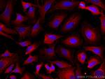 TXNRD1 Antibody in Immunocytochemistry (ICC/IF)