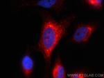 HSP47 Antibody in Immunocytochemistry (ICC/IF)