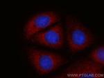 PSME1 Antibody in Immunocytochemistry (ICC/IF)