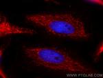HADHB Antibody in Immunocytochemistry (ICC/IF)