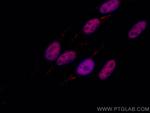 P53 Antibody in Immunocytochemistry (ICC/IF)