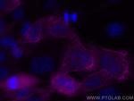 Cytokeratin 6A Antibody in Immunocytochemistry (ICC/IF)