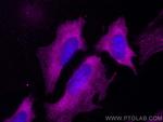 Septin 9 Antibody in Immunocytochemistry (ICC/IF)
