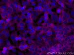 Annexin V Antibody in Immunocytochemistry (ICC/IF)