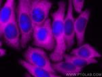 ENO1 Antibody in Immunocytochemistry (ICC/IF)