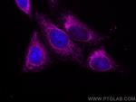 COXIV Antibody in Immunocytochemistry (ICC/IF)