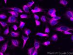 GRP94 Antibody in Immunocytochemistry (ICC/IF)
