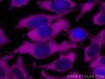 LDHB Antibody in Immunocytochemistry (ICC/IF)