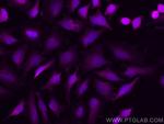 Thymidylate synthase Antibody in Immunocytochemistry (ICC/IF)