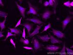 RABEPK/p40 Antibody in Immunocytochemistry (ICC/IF)