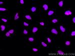 KAP1 Antibody in Immunocytochemistry (ICC/IF)