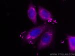 Transgelin-2 Antibody in Immunocytochemistry (ICC/IF)