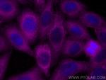 PKC Alpha Antibody in Immunocytochemistry (ICC/IF)