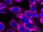 RRBP1 Antibody in Immunocytochemistry (ICC/IF)