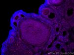LHCGR Antibody in Immunohistochemistry (PFA fixed) (IHC (PFA))