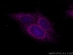Bcl-XL Antibody in Immunocytochemistry (ICC/IF)