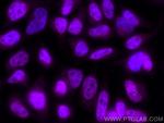 ERK1/2 Antibody in Immunocytochemistry (ICC/IF)