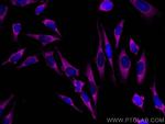 GDI2 Antibody in Immunocytochemistry (ICC/IF)