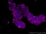 Chromogranin A Antibody in Immunocytochemistry (ICC/IF)