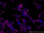Chromogranin A Antibody in Immunocytochemistry (ICC/IF)