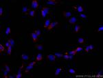CD107b/LAMP2 Antibody in Immunocytochemistry (ICC/IF)