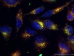 CD107b/LAMP2 Antibody in Immunocytochemistry (ICC/IF)