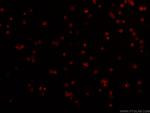 CD3 Antibody in Immunocytochemistry (ICC/IF)