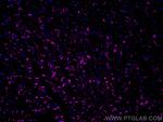 N-cadherin Antibody in Immunohistochemistry (PFA fixed) (IHC (PFA))