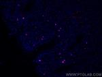 IgM Antibody in Immunohistochemistry (Paraffin) (IHC (P))