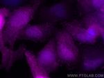 S100A4 Antibody in Immunocytochemistry (ICC/IF)