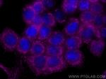 Decorin Antibody in Immunocytochemistry (ICC/IF)