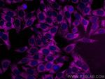 CAPN2 Antibody in Immunocytochemistry (ICC/IF)