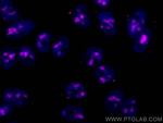 FBL Antibody in Immunocytochemistry (ICC/IF)