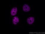 TDP-43 Antibody in Immunocytochemistry (ICC/IF)