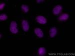 ANKRD1 Antibody in Immunocytochemistry (ICC/IF)