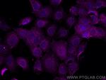 NSFL1C Antibody in Immunocytochemistry (ICC/IF)