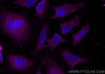 DNM2 Antibody in Immunocytochemistry (ICC/IF)