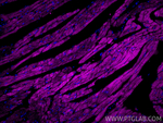 Cardiac Troponin T Antibody in Immunohistochemistry (Paraffin) (IHC (P))