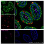 smooth muscle actin Antibody in Immunohistochemistry (PFA fixed) (IHC (PFA))