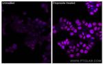 Phospho-P53 (Ser15) Antibody in Immunocytochemistry (ICC/IF)