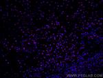 BCL2 Antibody in Immunohistochemistry (PFA fixed) (IHC (PFA))