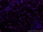 BCL2 Antibody in Immunohistochemistry (PFA fixed) (IHC (PFA))