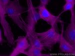 Beta Actin Antibody in Immunocytochemistry (ICC/IF)