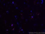 IBA1 Antibody in Immunohistochemistry (PFA fixed) (IHC (PFA))