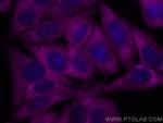 PCSK9 Antibody in Immunocytochemistry (ICC/IF)