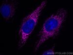 SOD2 Antibody in Immunocytochemistry (ICC/IF)
