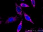 TRAP1 Antibody in Immunocytochemistry (ICC/IF)