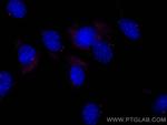 FGFR1OP Antibody in Immunocytochemistry (ICC/IF)